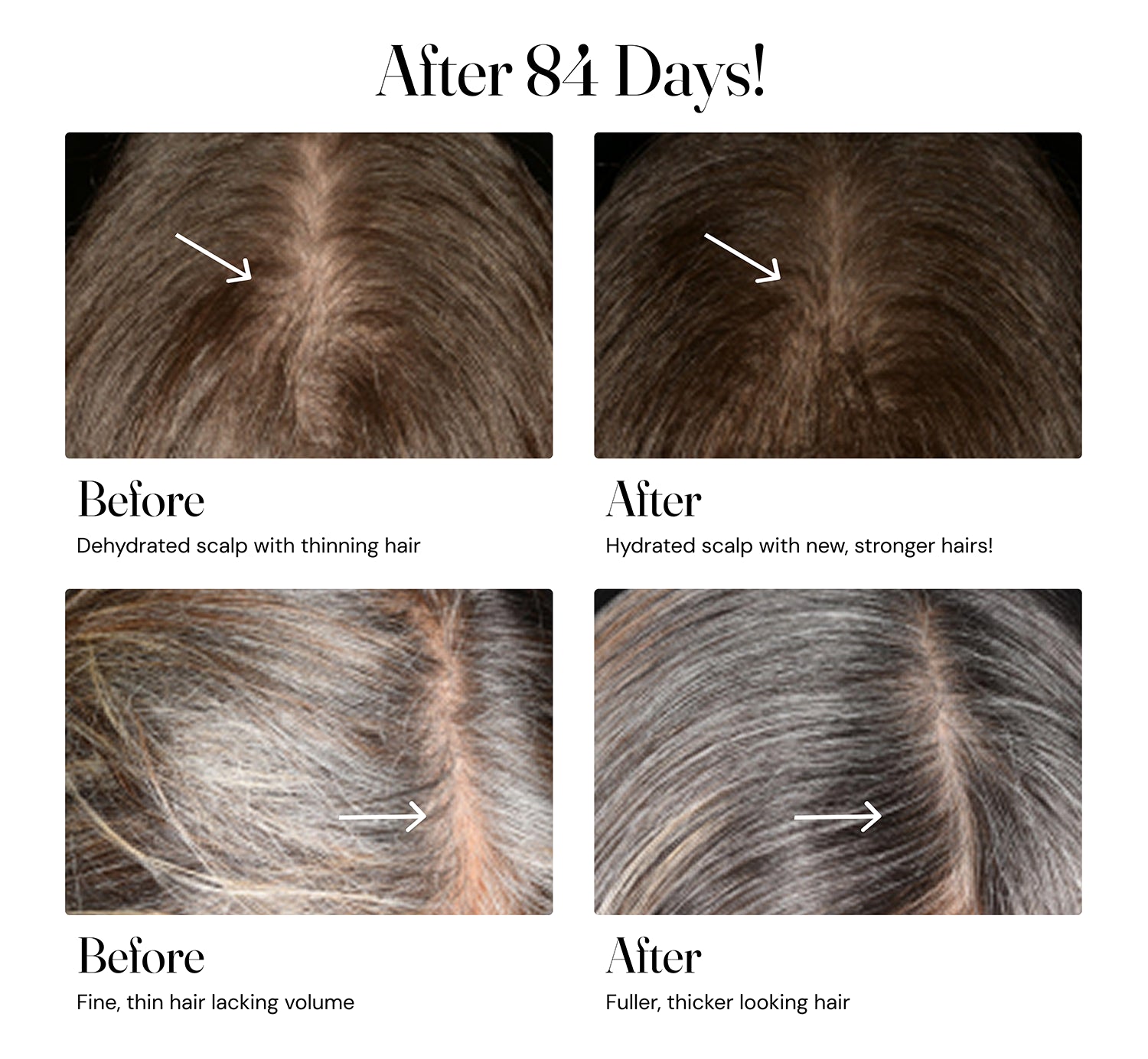 Before and after comparison of a hydrated scalp with new, stronger hair after 84 days.